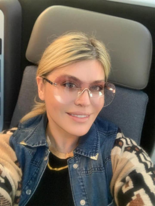 Loredana Groza a vorbit despre operațiile estetice pe care le are