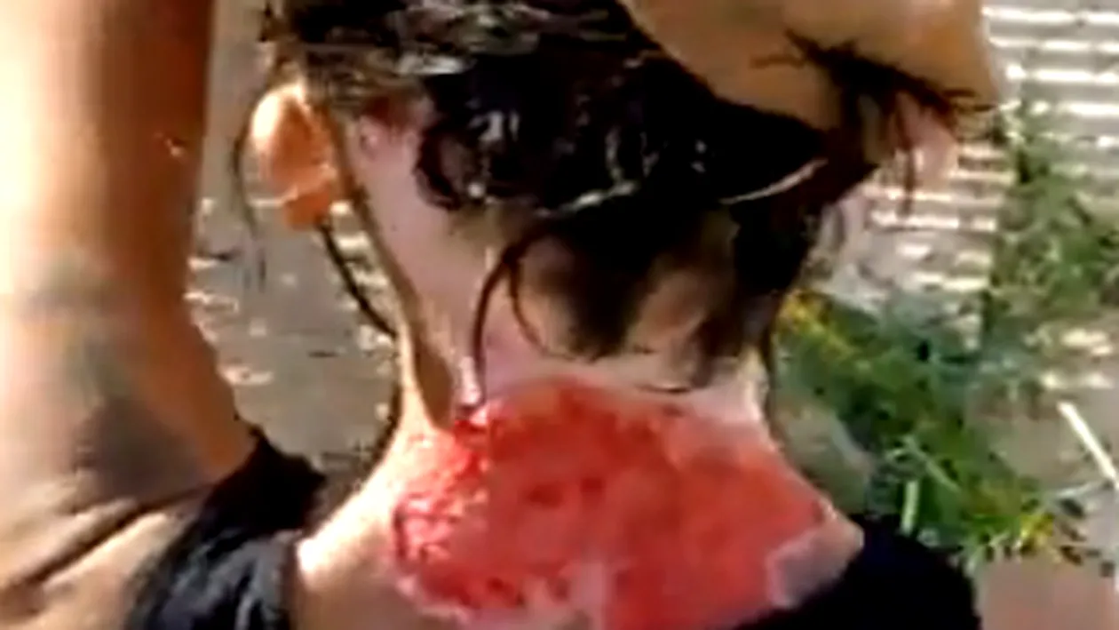 VIDEO Uite cum arata o drogata care s-a scarpinat pana la sange, dar spune ca a fost injunghiata