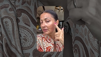 Gabriela Cristea și-a liniștit fanii după ce a apărut plină de pete pe ten. La ce procedură a apelat vedeta