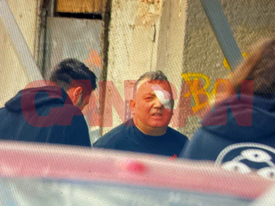Nuredin Beinur, cu ochiul bandajat, după scandal (Foto: CANCAN.RO)