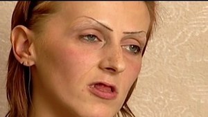 Aceasta femeie era mutilata la 27 de ani, apoi si-a recapatat chipul ca prin minune! Vezi cum arata astazi