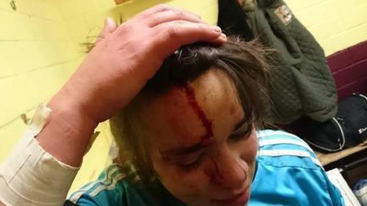 Atentie, imagini socante! Bataie ca-n filme la un meci de fotbal feminin! Si barbatii au fost agresati