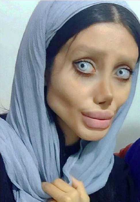 VIDEO & FOTO / O vedetă de pe Instagram a făcut 50 de operaţii estetice ca să arate precum Angelina Jolie! Rezultatul e înspăimântător şi nu are de gând să se oprească