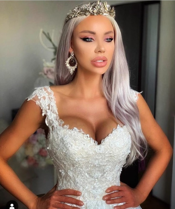 Bianca Drăgușanu, prima apariție după ce a fost învinețită de Alex Bodi. Cum arată corpul ei