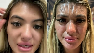 O tânără de 25 de ani a adormit pe plajă, în vacanță. Când s-a trezit a avut un șoc și a mers de urgență la medic