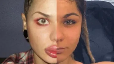 Trup de ZEITA, chip de DIAVOL! Cum ARATA aceasta tanara INAINTE sa recurga la aceste operatii EXTREME