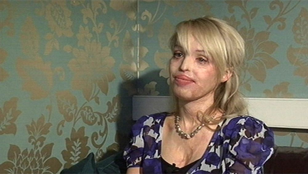 Este o celebră prezentatoare TV, dar în urmă cu 12 ani asta cerea: ”Omorâți-mă!” Drama fostului model, după ce iubitul a desfigurat-o cu acid sulfuric