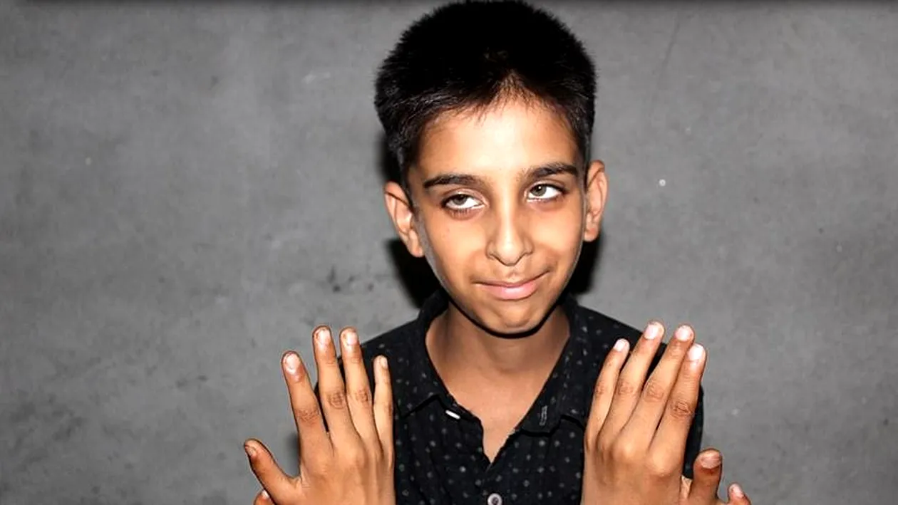 Un băiat s-a născut cu o malformație rară. Are 12 degete, iar părinții refuză să îl opereze. Motivul invocat de aceștia este fabulos | VIDEO