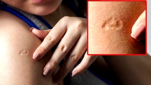 Descoperire uluitoare pentru români! Ai și tu acest semn pe braț? Te-ar putea feri de coronavirus