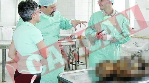 A facut hepatita din cauza formolului