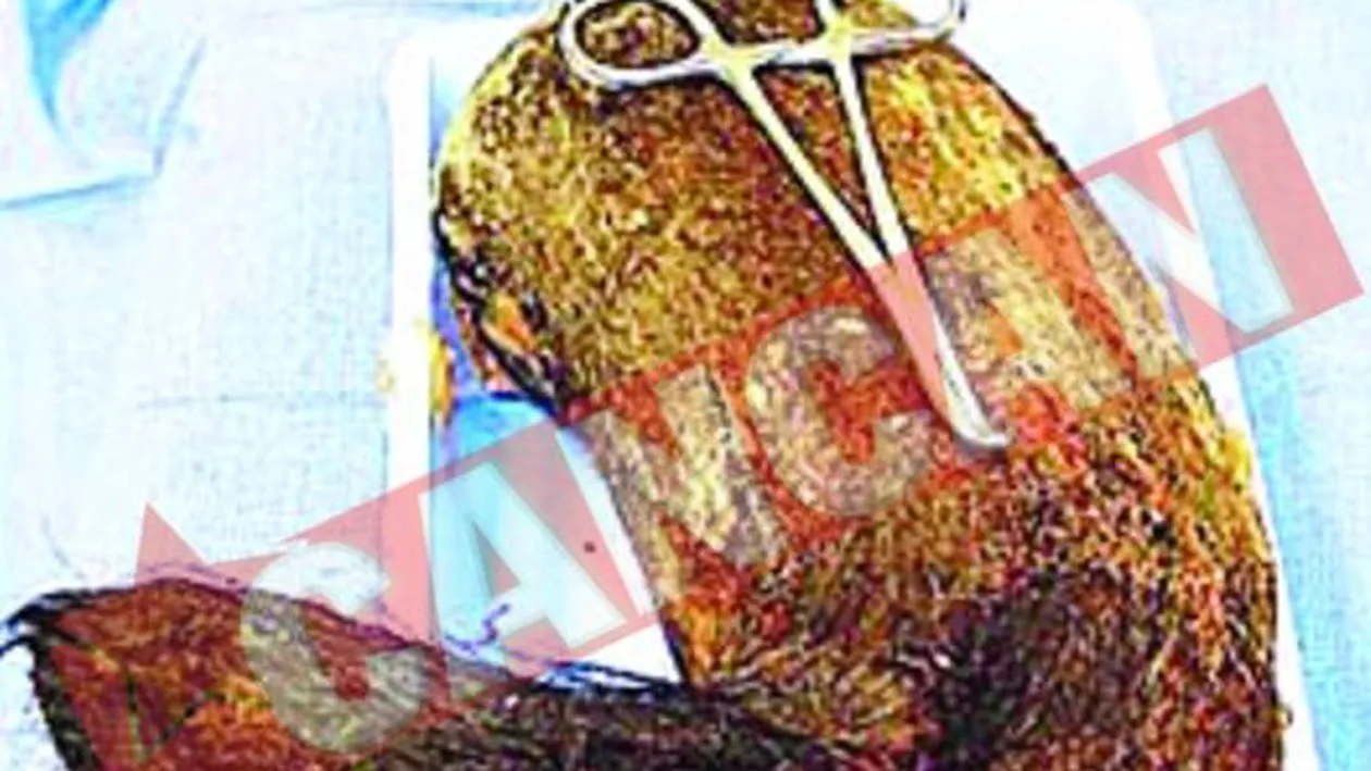 A mancat cinci kilograme de par