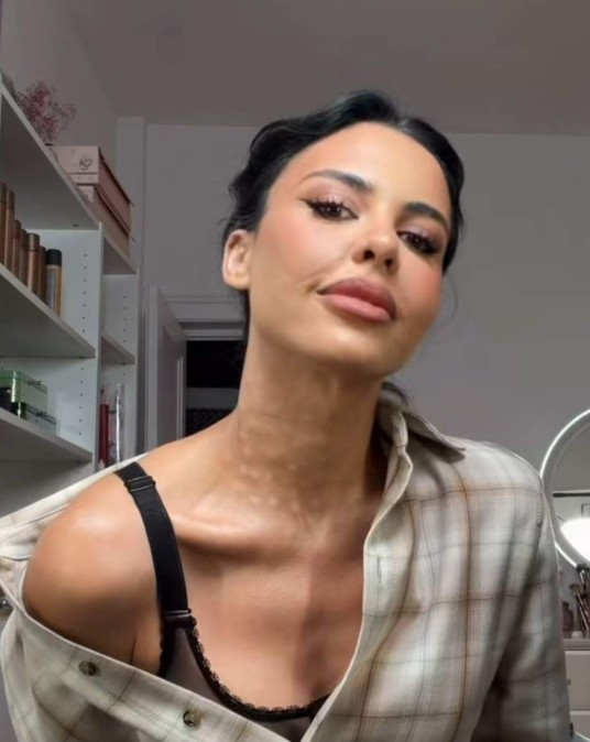 Andreea Popescu a stârnit îngrijorare cu ultima apariție! De unde sunt urmele de pe gât