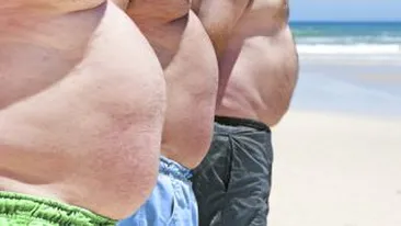 Potrivit unui studiu, obezitatea contribuie la aparitia dementei