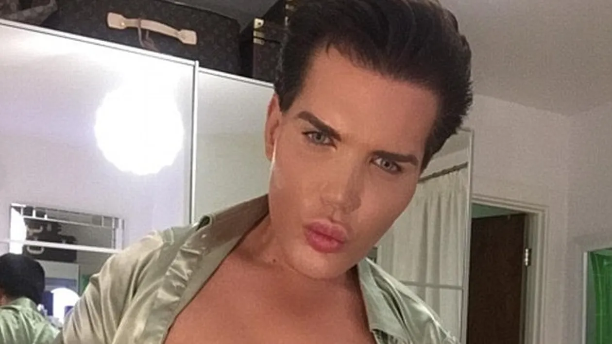 A fost la un pas să rămână fără nas, însă acum a revenit pe TV! Rodrigo Alves, bărbatul care a 43 de operaţii estetice, a venit în România şi a spus totul despre drama lui
