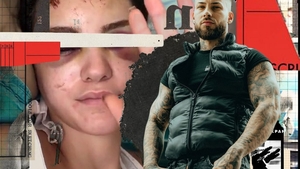 Vedeta Tik-Tok a apărut învinețită, iar imaginile s-au viralizat. "M-a făcut să am ochii așa tumefiați, ca de raton”