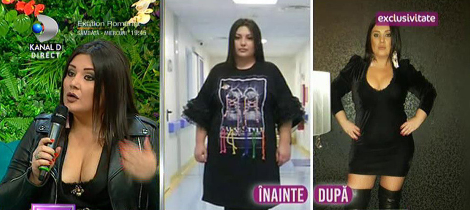 Bianca Rus a slăbit 11 kilograme, după ce și-a tăiat stomacul! Cum arată acum: “Mai trebuie să scap de 25“