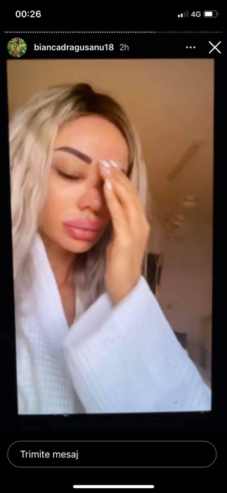 Bianca Drăgușanu a publicat mai multe imagini după ce a fost snopită de Alex Bodi: “Pentru pozele în care apar bătută, am depus o plângere penală” | FOTO