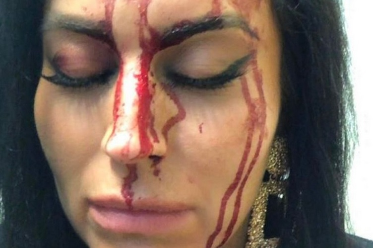 Prezentatoarea TV a ajuns plină de sânge la spital. Imagini cu puternic impact emoțional