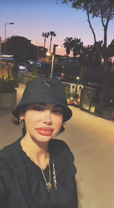 Alina Eriko începe să își revină. Cum arată acum, după ce și-a refăcut dantura