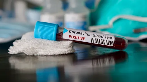 Bilanț decese coronavirus în România, 5 iunie 2021. Numărul morților din ultimele 24 de ore
