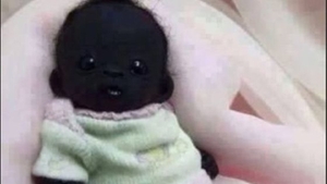 Vă mai amintiţi de Edam, cel mai negru bebeluş din lume? Iată cum arată acum, la 4 ani