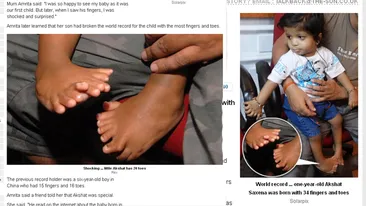 Uite cum arata copilul care are 34 de degete! Unic in lume