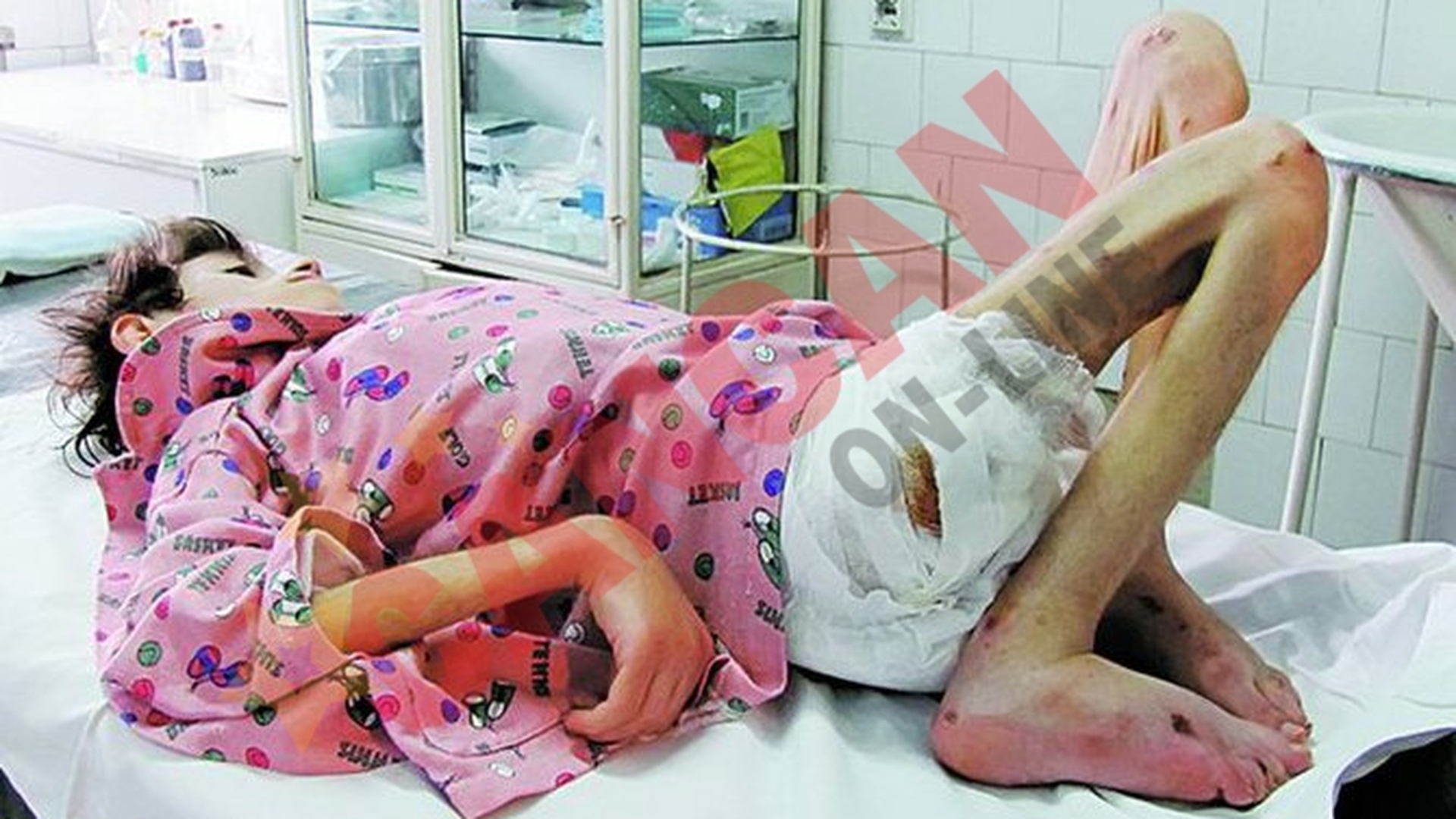 Fata de 15 ani care a ajuns la spital cantarind doar 13 kilograme mai are doar cateva zile de trait