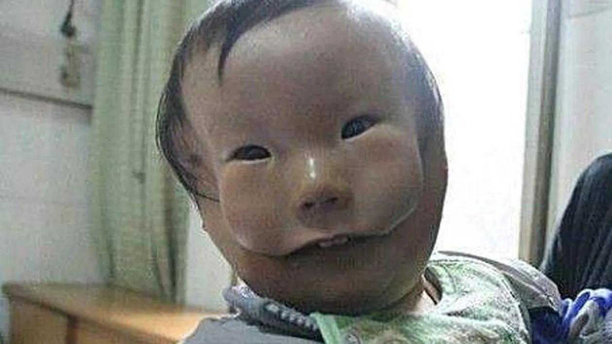 Imagini Socante! Bebelusul care s-a nascut cu o masca in loc de fata!