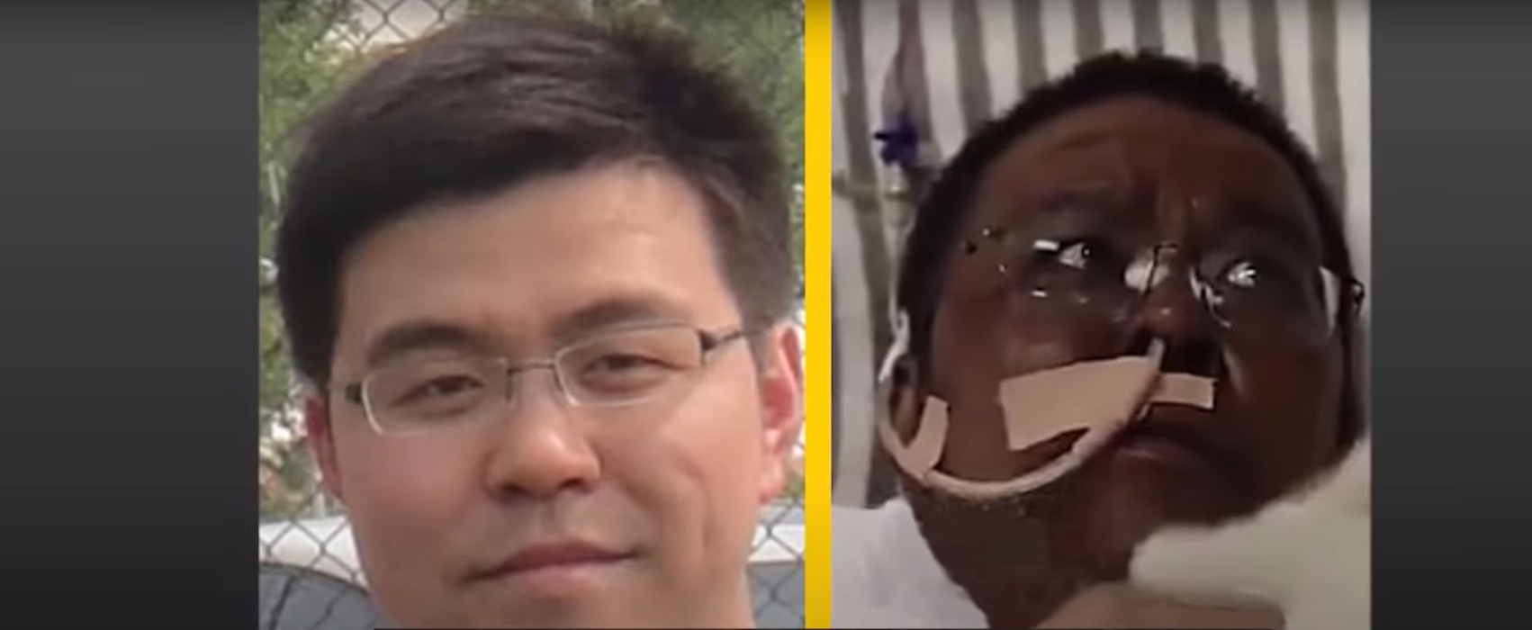 Incredibil! Infectați cu noul coronavirus, doi medici chinezi s-au trezit cu pielea închisă la culoare! Explicațiile specialiștilor