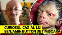 Cum arată acum singurul copil-bătrân din România, care îmbătrânește invers. Benjamin Button de Timișoara