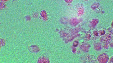 Pericol! Exista o amiba care se hraneste cu creierul uman!