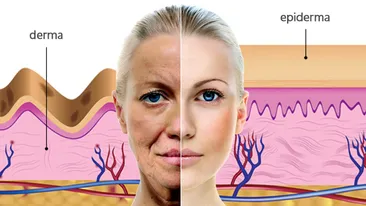 (P) De ce nu dispar ridurile doar cu ajutorul cremelor?