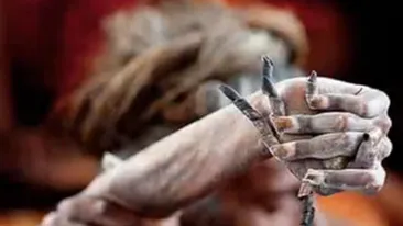 GROAZNIC! A stat cu o mana ridicata in aer timp de 38 de ani! Uite in ce hal a ajuns sa arate bratul acestui barbat!