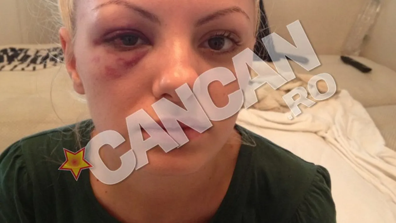 Alexandra Stan, despre cosmarul provocat de manager: “M-a batut pana am lesinat, apoi m-a aruncat din masina, plina de sange!”