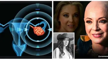 Care sunt simptomele cancerului ovarian, maladia care i-a adus sfârșitul lui Edith González
