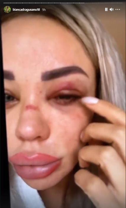 Bianca Drăgușanu a arătat din greșeală înregistrarea cutremurătoare în care este leșinată lângă pat: “Am trăit în casă cu un om care mă filma non stop! Nu ți se pare că ăsta e șantaj?!”