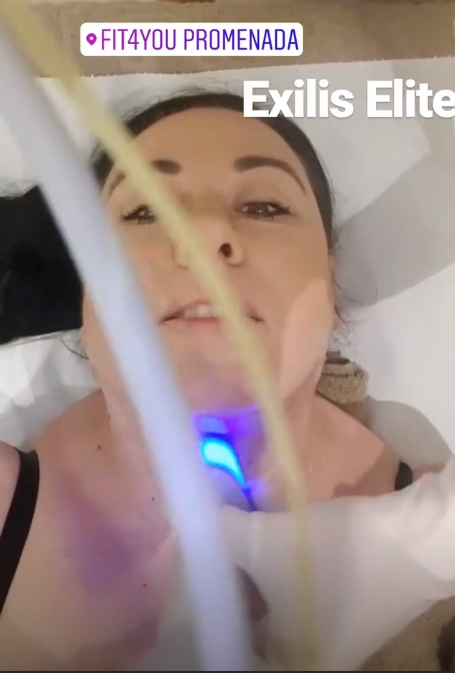 Oana Roman “și-a sculptat” fața! S-a filmat în timpul procedurii estetice