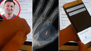 Motivul pentru care George Buhnici și-a implantat un microcip în mâna stângă: "Un doctor mi l-a injectat cu o seringă"