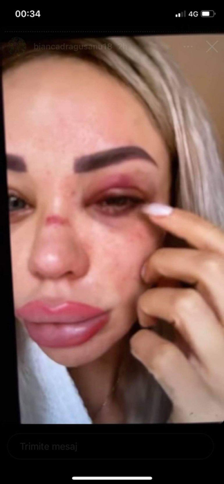 Alex Bodi a recunoscut! De ce a bătut-o, de fapt, pe fosta lui soţie, Bianca Drăguşanu: „Să dau eu într-o femeie trebuie să existe o sumedenie de provocări”