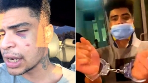 Un cântăreț din România, rupt cu bătaia de polițiștii din Cluj-Napoca: "Uitați cum m-au umflat gaborii de la Secția 4!"