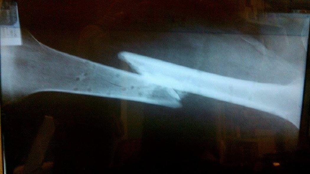 Oasele lui Nicu erau zob la externare