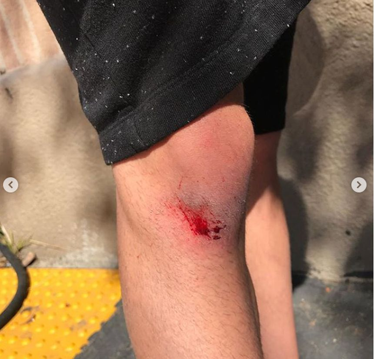 Tânărul rănit în urma accidentului în care a fost implicat celebrul actor.  Sursa foto: Instagram