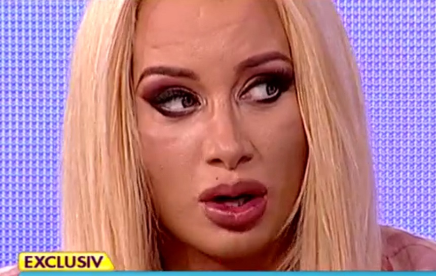 Simona Traşcă şi-a scos firele de la operaţie! Cum arată acum vedeta care a vrut să se sinucidă