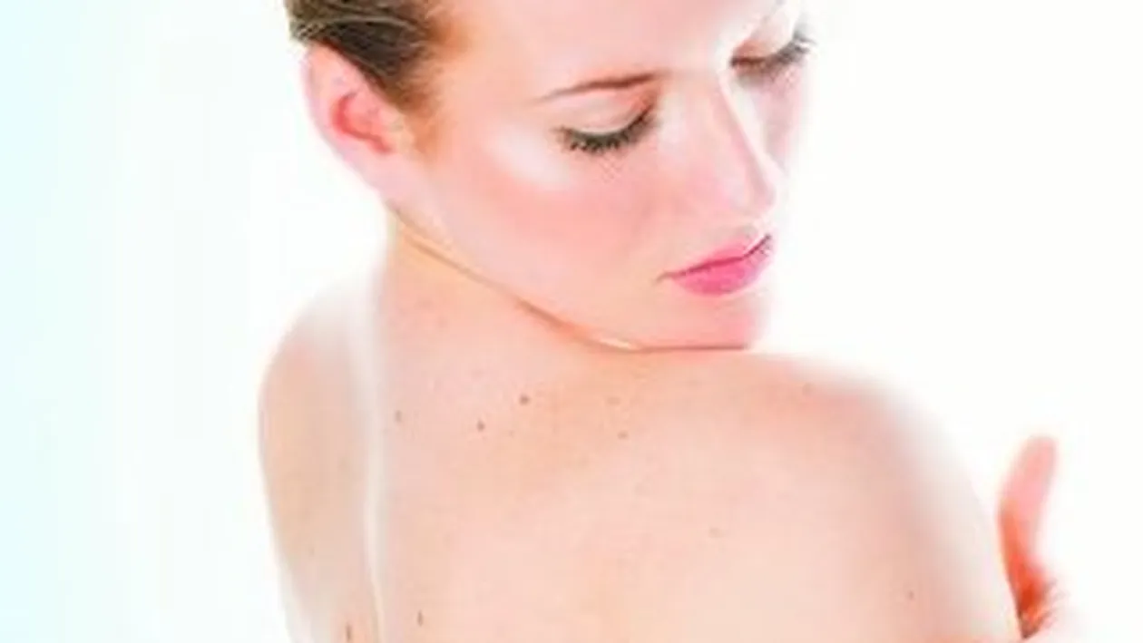 Tot ce trebuie sa stii despre melanom. Cum sa prevenim cancerul de piele