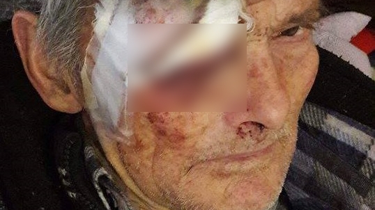 Şocant. O vâlceancă a postat pe Facebook poze cu tatăl ei, bătut crunt