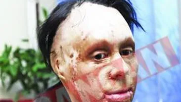 A facut 20 de operatii de reconstructie a fetei