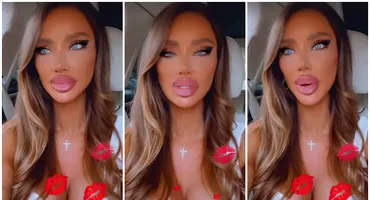 De ce își topește Bianca Drăgușanu acidul din buze. Vedeta a recunoscut ce s-a întâmplat