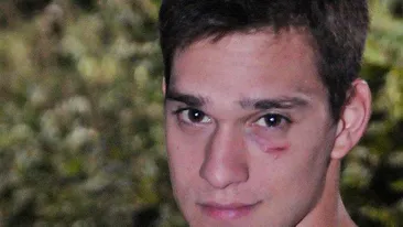 Vlad din Pariu cu viaţa a rămas cu un semn la ochi după filmările pentru episodul cu atentatul! Vezi ce i s-a întamplat!