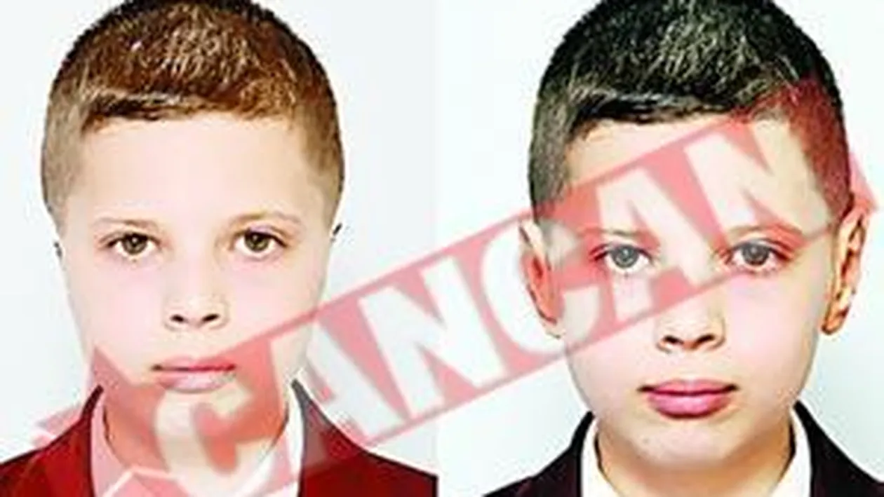 S-a nascut fara urechi