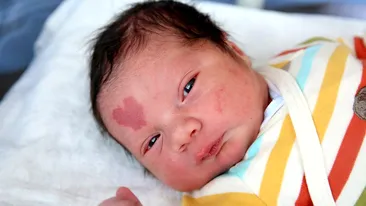 Cazul care a uimit medicii. O femeie a născut un bebeluș cu o inimă în frunte. Cum arată băiețelul acum, la 6 ani